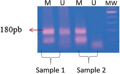 Physical Activity Level Influences MTHFR Gene Methylation Profile in Diabetic Patients